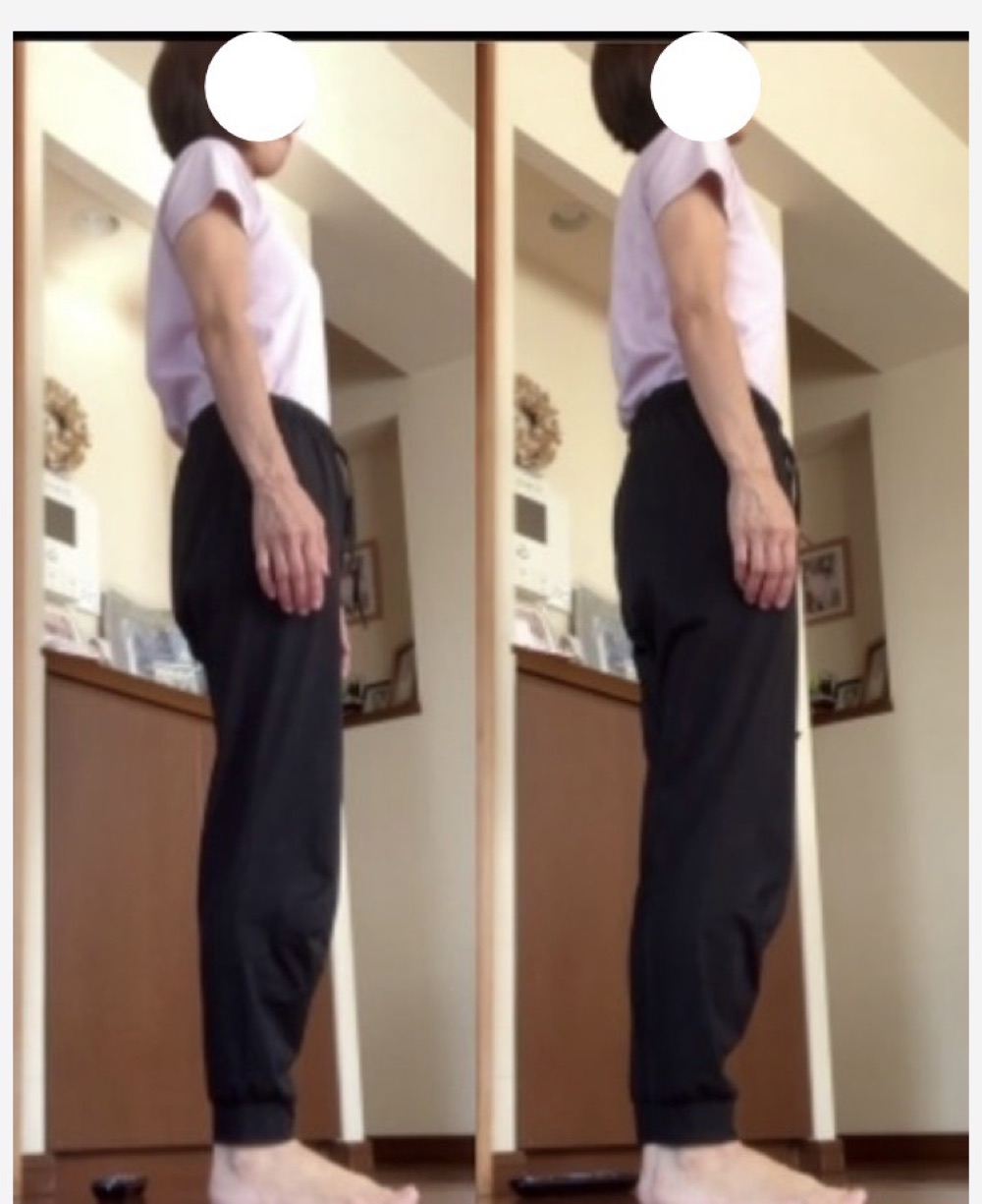 60代女性のビフォーアフター